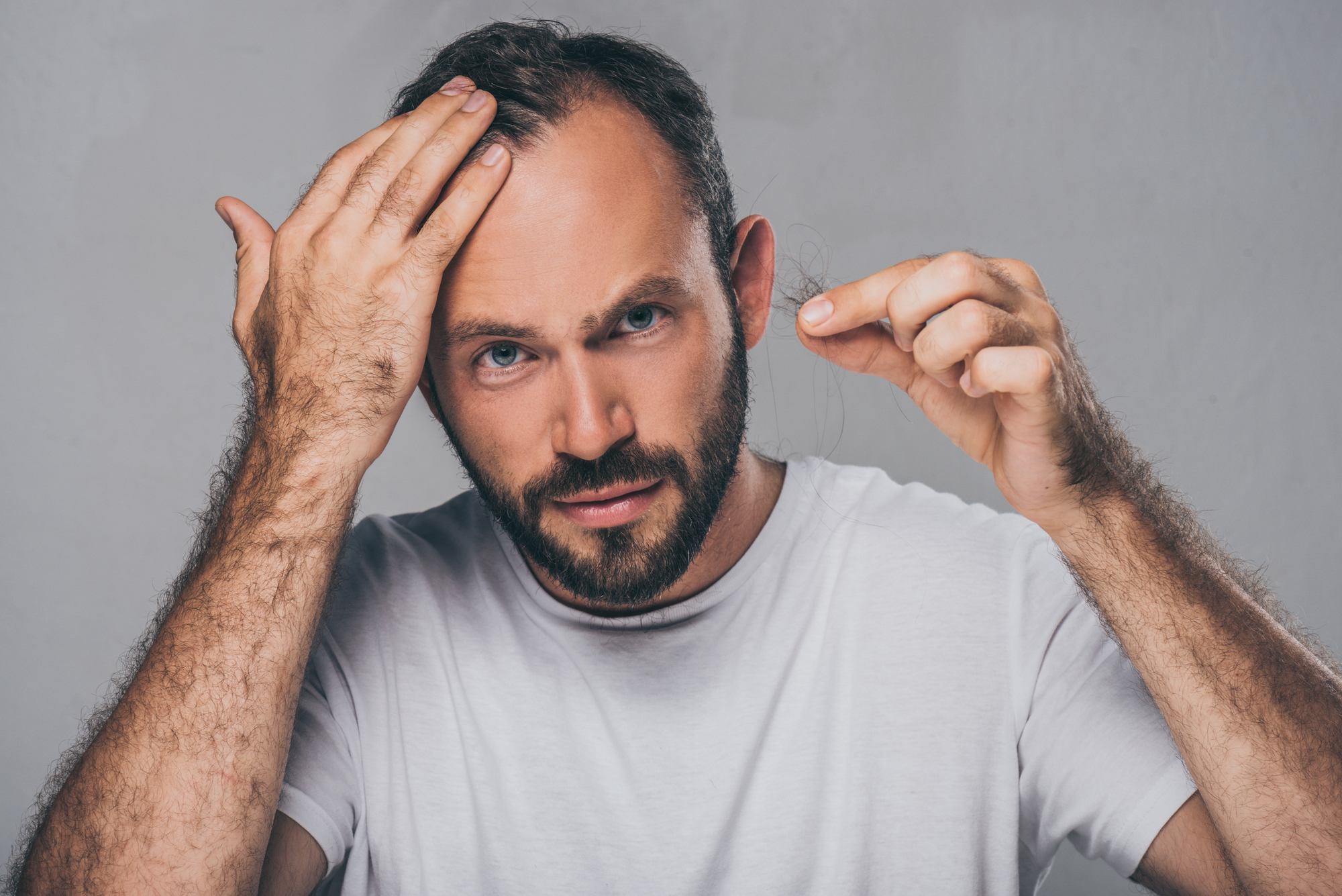 Read more about the article How To Tell If You’re a Good Candidate for Hair Transplant